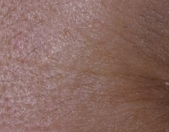 脫羧肌肽鹽酸鹽矽烷三醇